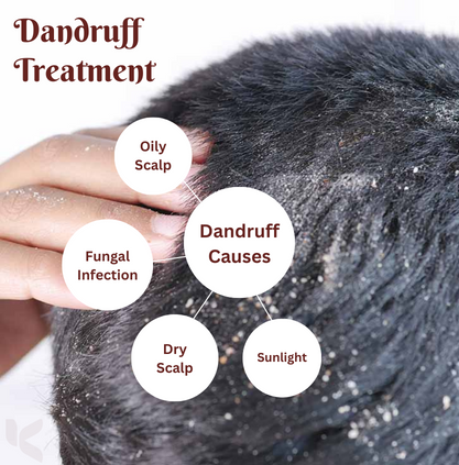 A man seeking the best dermatologists in Coimbatore for dandruff treatment to treat his fungal hair.