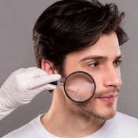 Using a magnifying lens to examine his dry face, a man pays special attention to minutiae