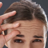 A woman who appears to be stressed for facial wrinkles with her hands resting on her forehead