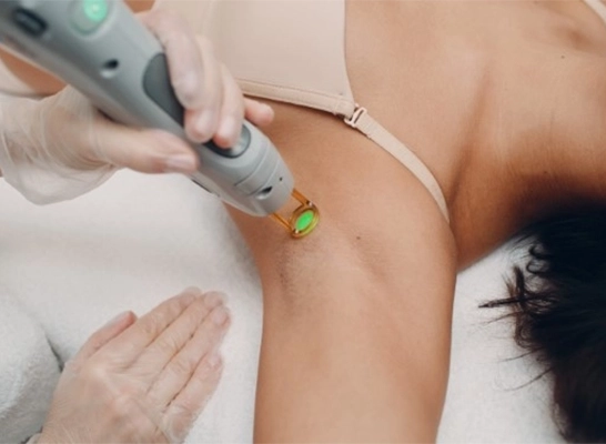 Painless laser hair removal near Selvapuram for smooth skin. Safe, quick, and long-lasting results.