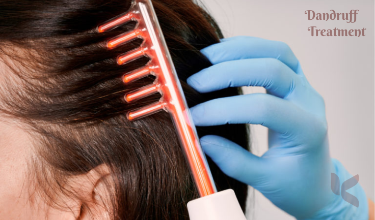 A female-focused on Scalp Anti-Dandruff Treatment after using a comb to go around her hair.