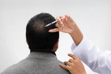 A physician giving a man a hair transplant to improve his appearance and restore his hairline